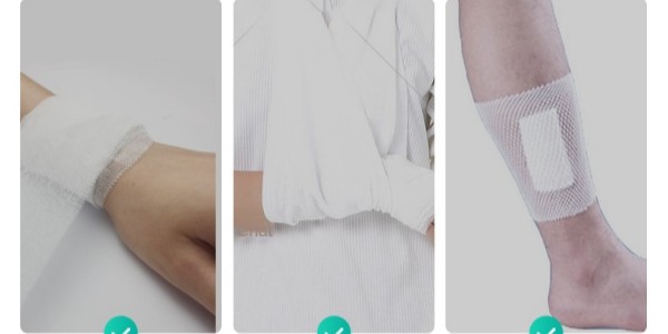 醫(yī)用繃帶根據(jù)變色標(biāo)示創(chuàng)口情況