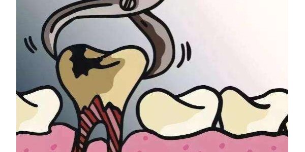 拔牙后咬的棉球上有藥嗎