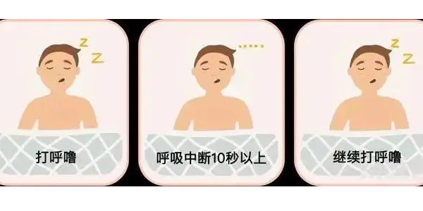 你真的了解睡眠呼吸暫停嗎？6600萬中重度患者正在受害！—仟龍醫(yī)療