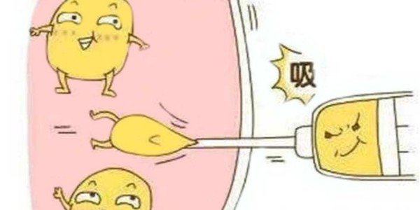 注射器吸脂術是什么