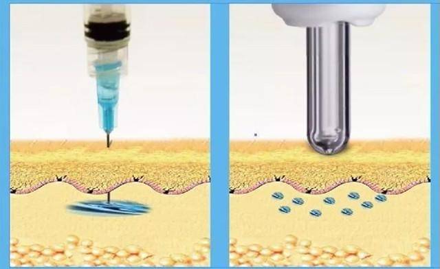 使用無針注射器的價(jià)格是多少