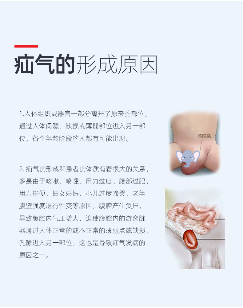 疝氣形成的原因