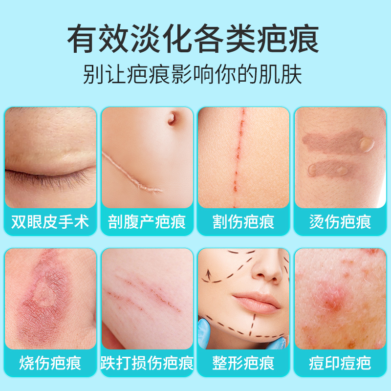 祛疤膏主圖4