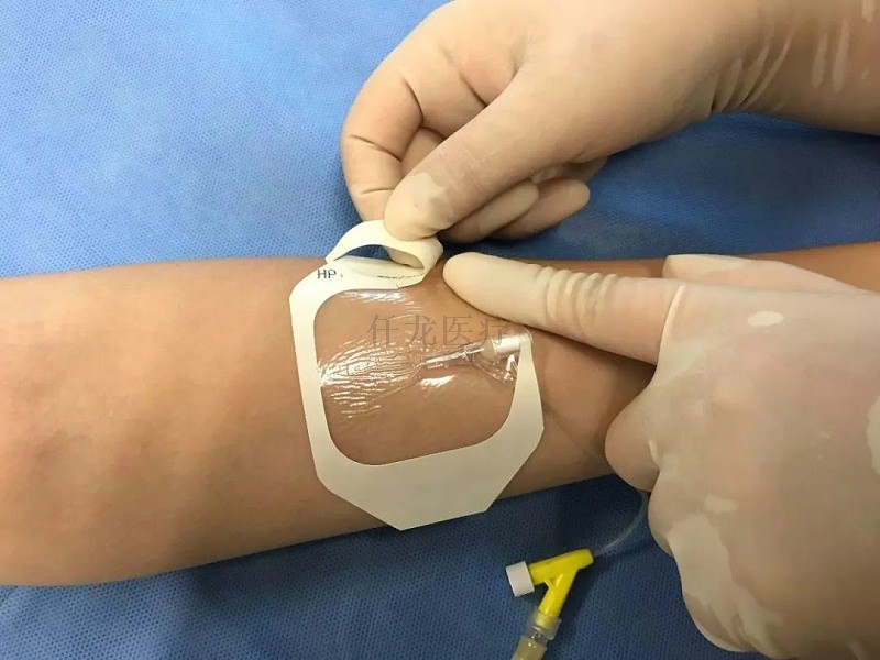 留置針的常見并發(fā)癥要怎么預防