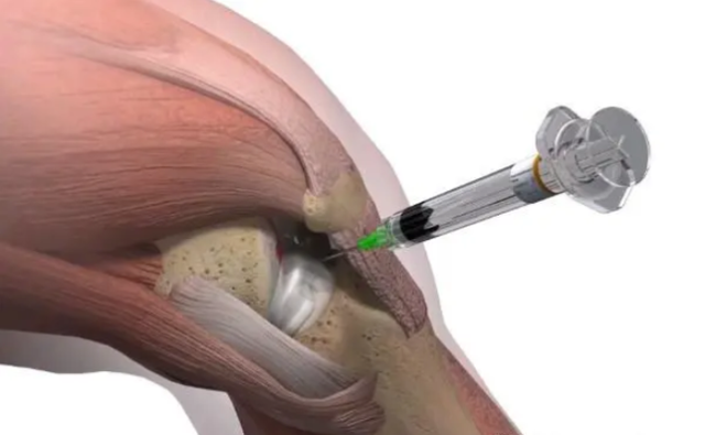 用注射器打完封閉針多久可以洗澡