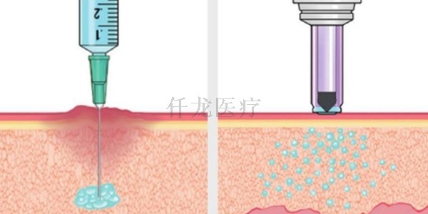 無針注射器讓糖尿病患者免受扎針痛苦